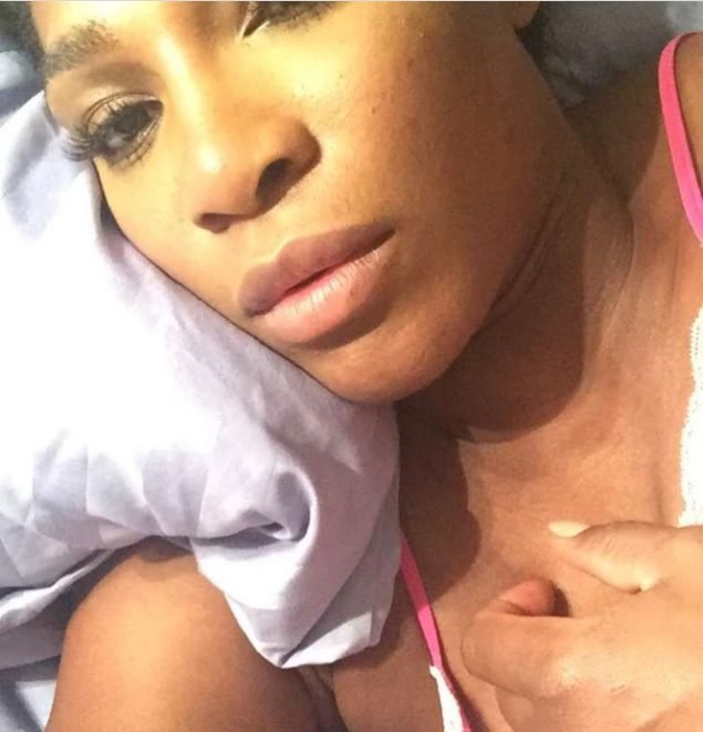 Serena Williams pregnancy confirmed