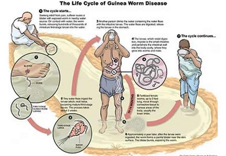 Guinea worm life cycle