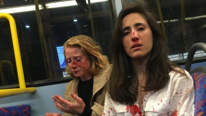 The couple Melania Geymonat (right) and her girlfriend Chris needed hospital treatment