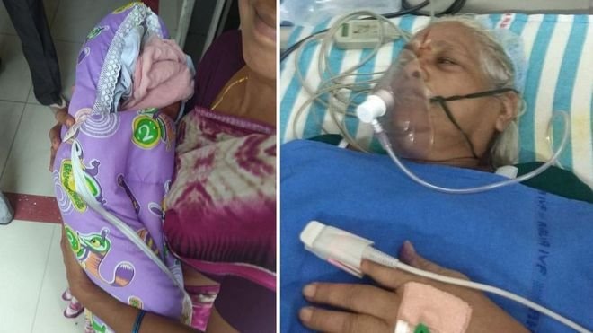 Mangayamma Yaramati, 73, gave birth after 54 years of waiting