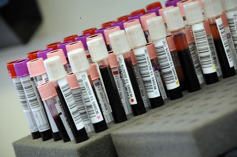 The blood of people who recovered from Covid-19 needed for trial