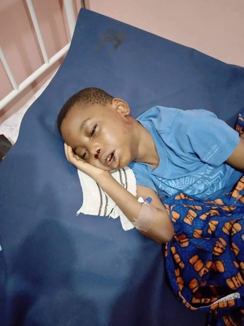 Prosper Chiebuka Chinonso needs N25 million for bone marrow transplant
