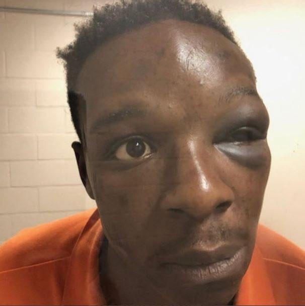 A mugshot of Roderick Walker after he was battered by a deputy sheriff in Clayton County, Georgia