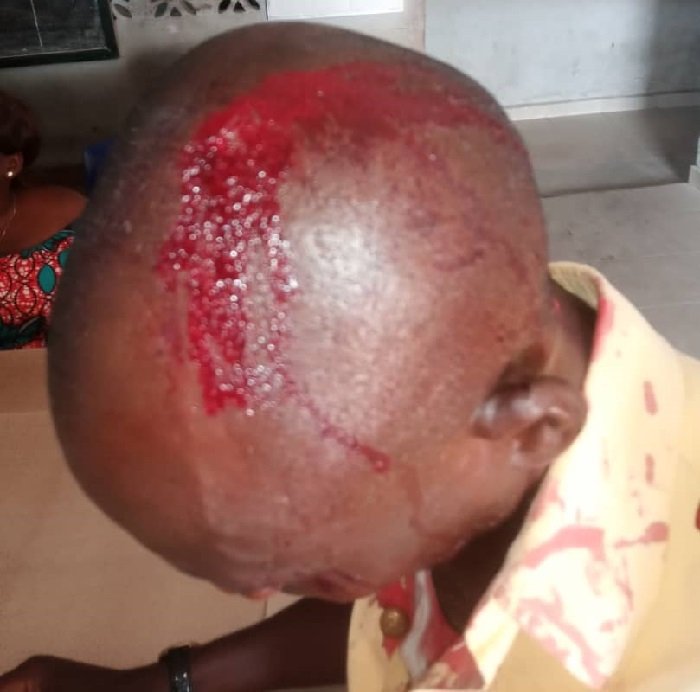 LASTMA officer was attacked by a motorist