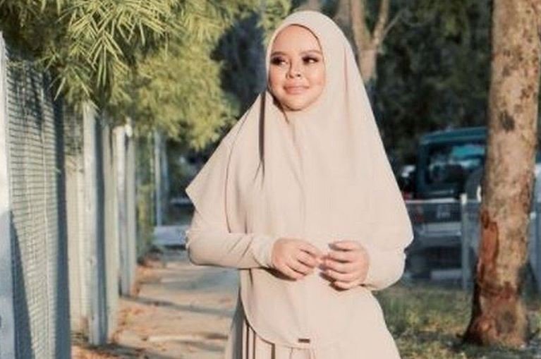 Siti Sarah Raisuddin was a popular singer in Malaysia died of COVID