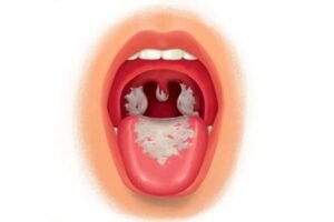 Diphtheria strikes children in Kaduna community