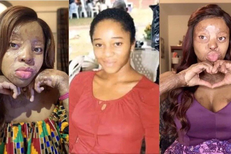 Kechi Okwuchi, a survivor of the tragic Sosoliso plane crash 18 years ago and America's Got Talent star, has paid tribute to the 60 classmates who died in the tragic incident.