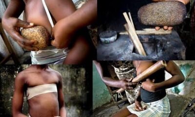 Age-long tradition breast ironing could lead to cancer in the affected girls